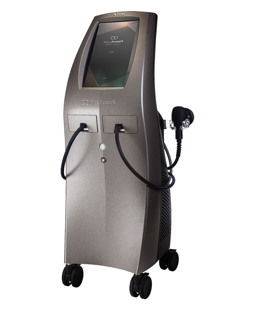 Alma PrimeX