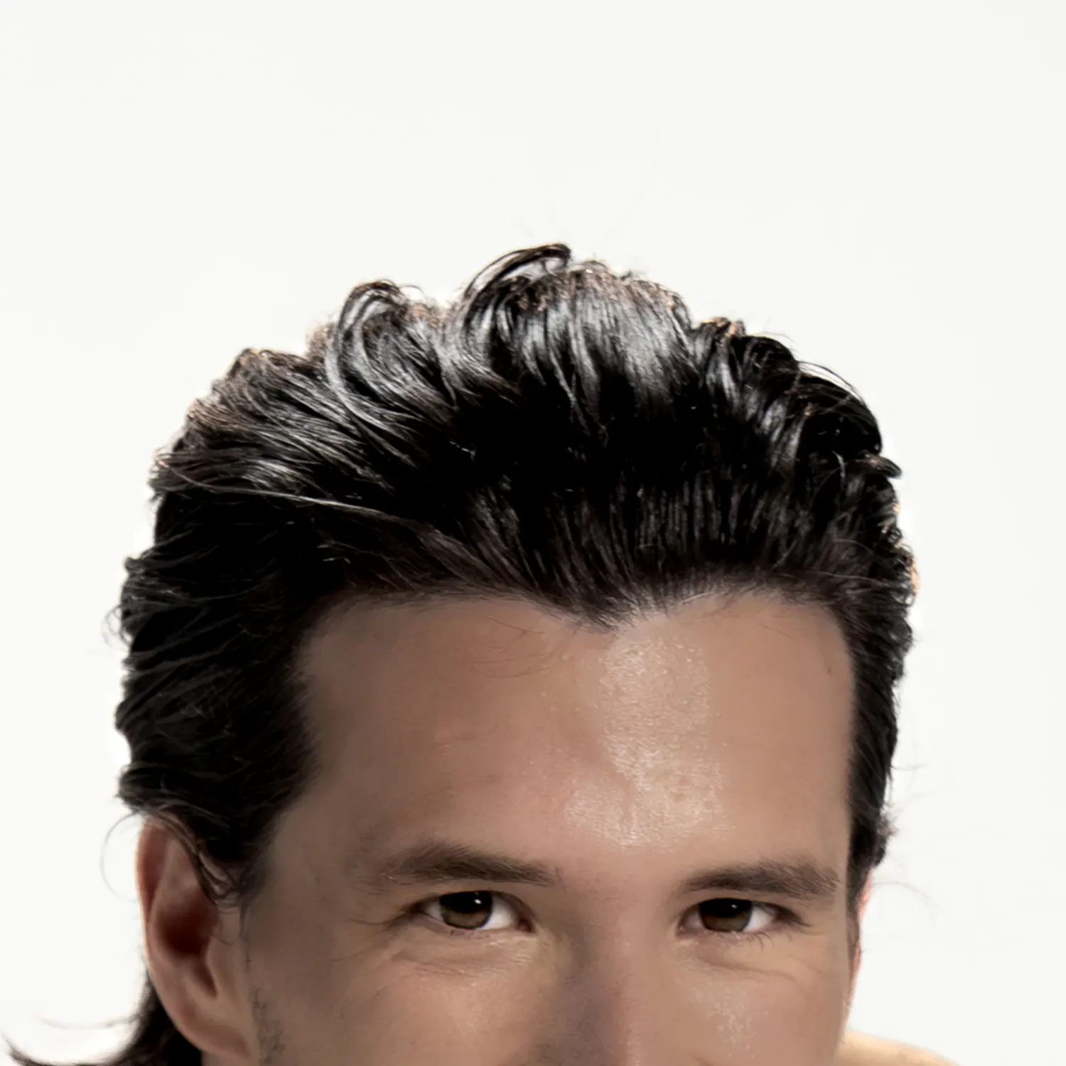 Depilación láser FRENTE Depilación láser FRENTE