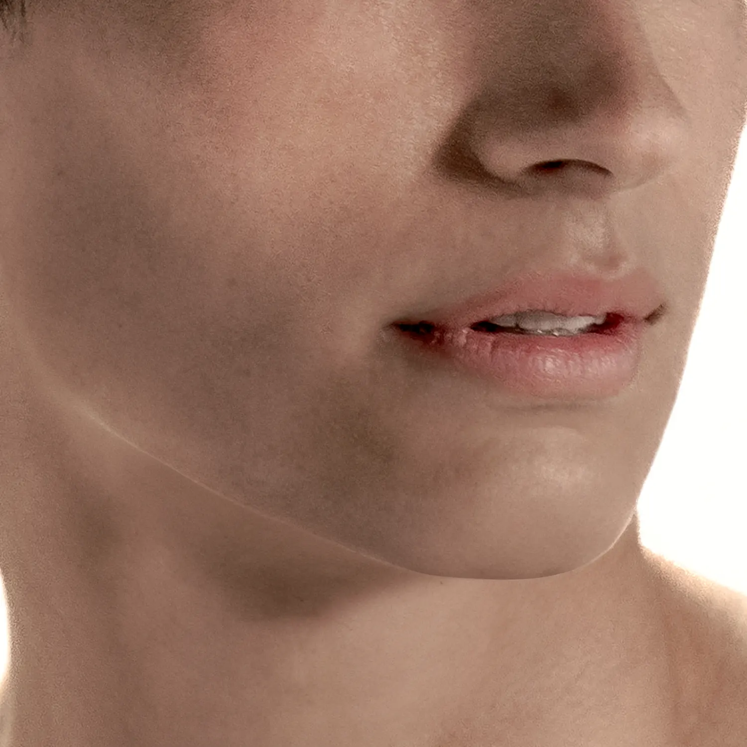 Depilación láser BARBA Depilación láser BARBA